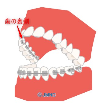 ハーフリンガル