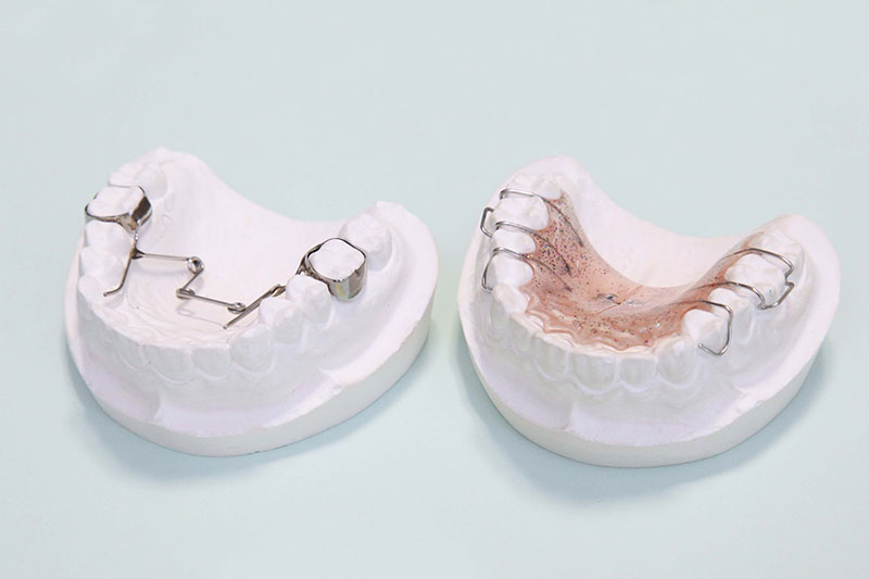 装置を装着して治療を開始