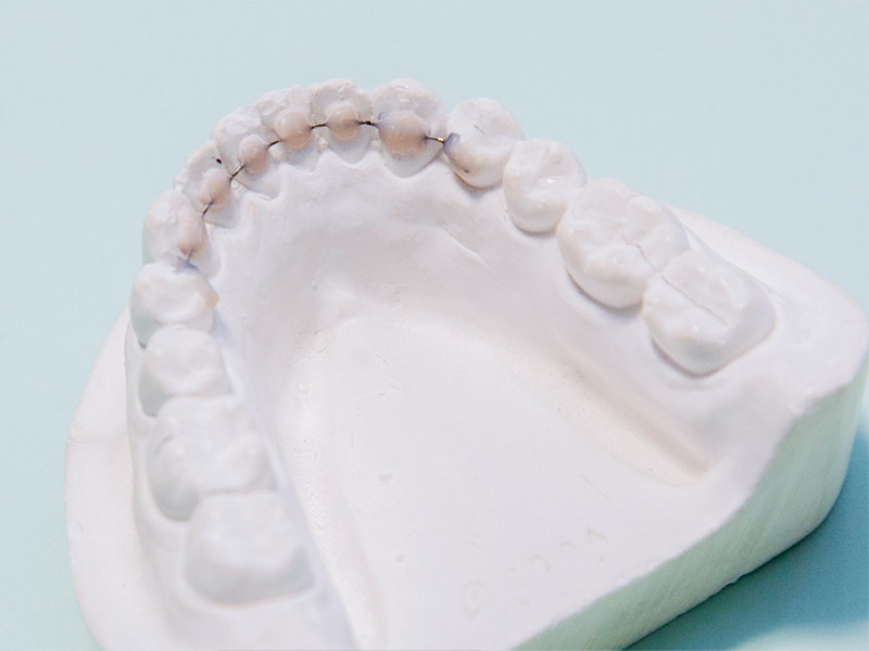 8.保定装置装着