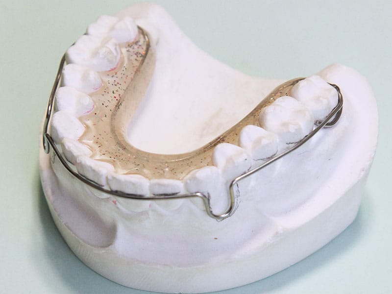 8.保定装置装着