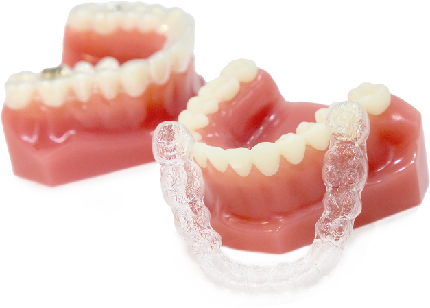 マウスピース型矯正装置（インビザライン）